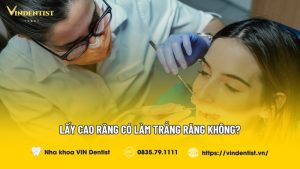 Lấy Cao Răng Có Làm Trắng Răng Không