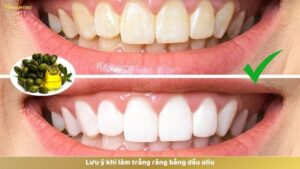 Lưu ý khi làm trắng răng bằng dầu oliu