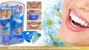 Máy làm trắng răng có thực sự hiệu quả?