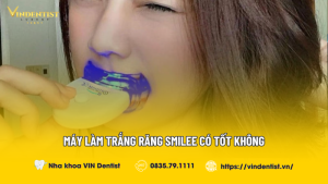 Máy Làm Trắng Răng Smilee Có Tốt Không