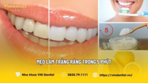 Mẹo làm trắng răng trong 5 phút