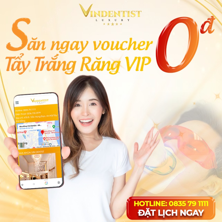 Làm Gì Sau Khi Tẩy Trắng Răng? 15 Nên tẩy trắng răng ở đâu để hiệu quả?