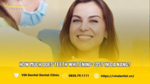 teeth whitening in danang