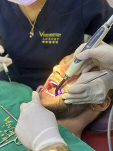 The outcomes of dental fillings performed at VIN Dentist 6