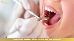 Bao lâu thì đưa trẻ đi lấy cao răng 1 lần?