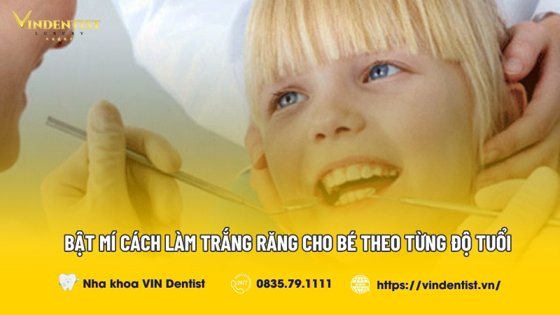 Bật Mí Cách Làm Trắng Răng Cho Bé Theo Từng Độ Tuổi