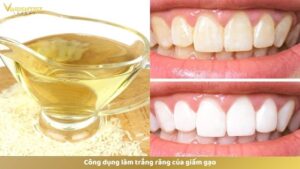 Công dụng làm trắng răng của giấm gạo