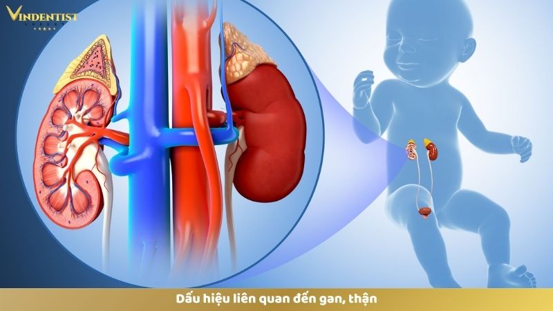 Bật Mí Cách Làm Trắng Răng Cho Bé 1 Tuổi An Toàn, Hiệu Quả 11 Dấu hiệu liên quan đến gan, thận