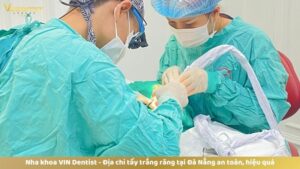 Địa chỉ tẩy trắng răng tại Đà Nẵng an toàn, hiệu quả lâu dài