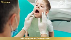 Điều trị sưng nướu có mủ đau không?