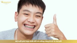 Độ tuổi phù hợp nhất để trẻ niềng răng