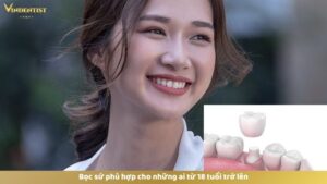 Độ tuổi thích hợp để bọc răng sứ