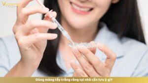 Dùng máng tẩy trắng răng tại nhà cần lưu ý gì?