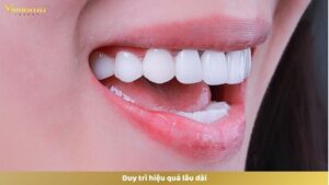 Duy trì hiệu quả lâu dài