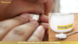 Làm trắng răng bằng giấy bạc có an toàn không?