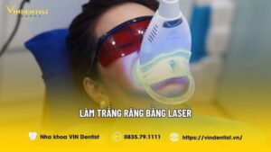 Làm Trắng Răng Bằng Laser Là Gì? Có Nên Áp Dụng Không?
