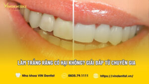 Làm Trắng Răng Có Hại Không
