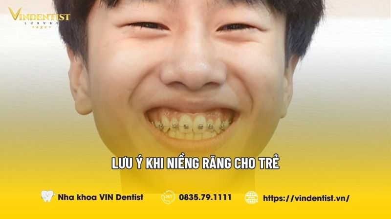 Những Lưu Ý Khi Niềng Răng Cho Trẻ | Nha khoa VIN Dentist