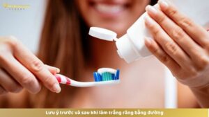 Lưu ý trước và sau khi làm trắng răng bằng đường