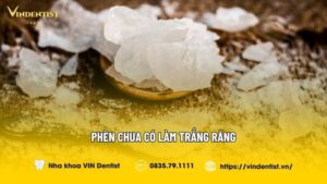 Phèn Chua Có Làm Trắng Răng Không? | Nha Khoa VIN Dentist