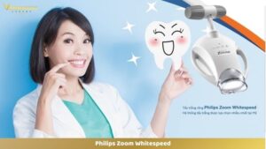 Philips Zoom Whitespeed
