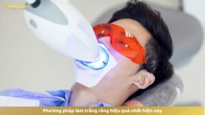 Phương pháp làm trắng răng hiệu quả nhất hiện nay