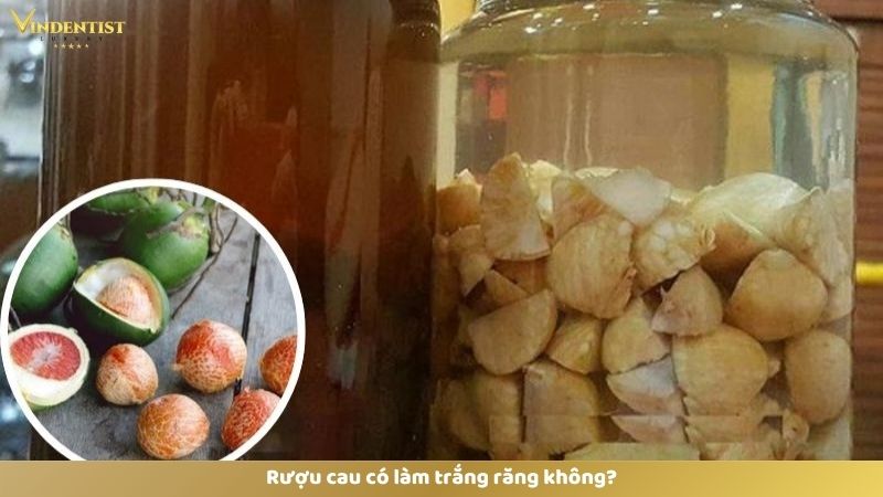 Rượu Cau Có Làm Trắng Răng Không? Cách Làm Ra Sao? 9 Rượu cau có làm trắng răng không?