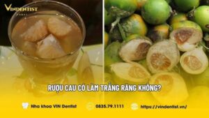 Rượu Cau Có Làm Trắng Răng Không? Cách Làm Ra Sao?