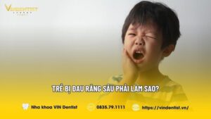 Trẻ Bị Đau Răng Sâu Phải Làm Sao? | Nha khoa VIN Dentist