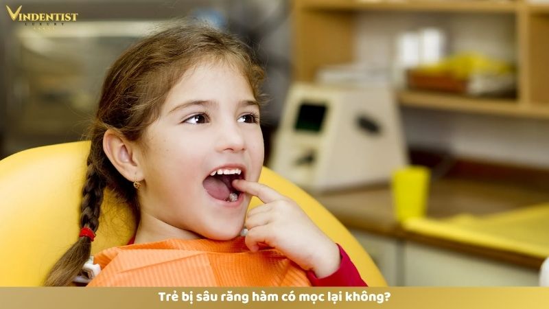 Trẻ Bị Sâu Răng Hàm: Bố Mẹ Cần Làm Gì Và Cách Phòng Tránh 24 Trẻ bị sâu răng hàm có mọc lại không?