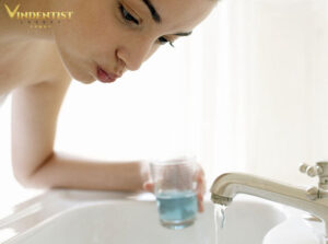 Sau khi sử dụng máy làm trắng răng