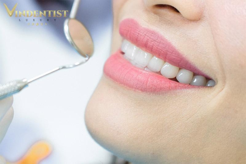  Chuẩn bị tâm lý tốt trước khi trồng implant