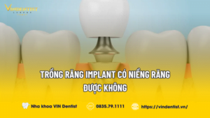 Trồng răng implant có niềng răng được không