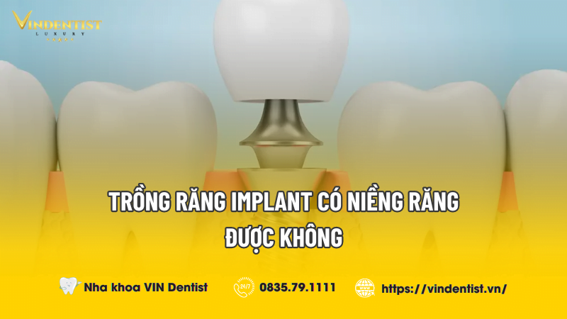 Trồng răng implant có niềng răng được không