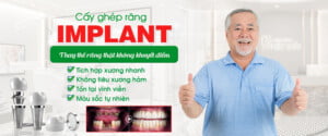 Trồng răng implant tại Nha khoa Việt Đức