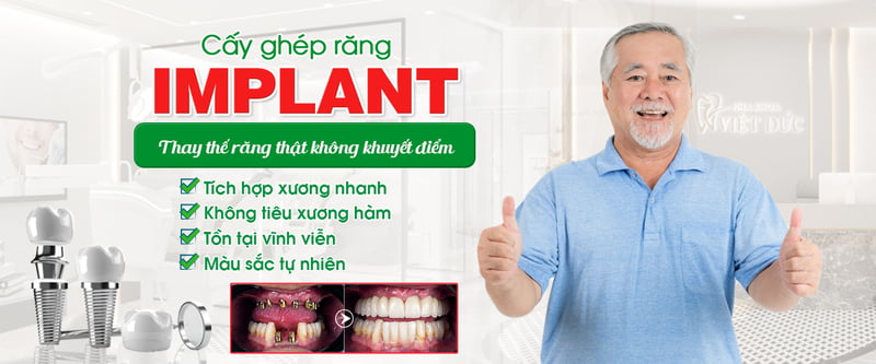 Dịch vụ Trồng Răng Implant Uy Tín Tại Đà Nẵng 43 Trồng răng implant tại Nha khoa Việt Đức