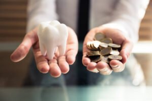 Điều trị tủy răng giá bao nhiêu?