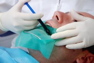 Quy trình điều trị tủy răng như thế nào?