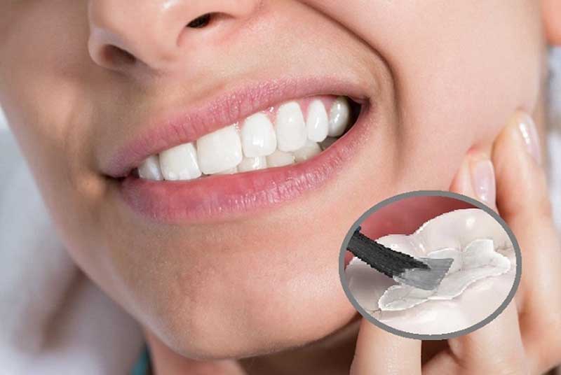 Trám Răng Sâu Bao Nhiêu Tiền? Có Bị Sâu Lại Không? 20 Quy trình trám răng sâu như thế nào?