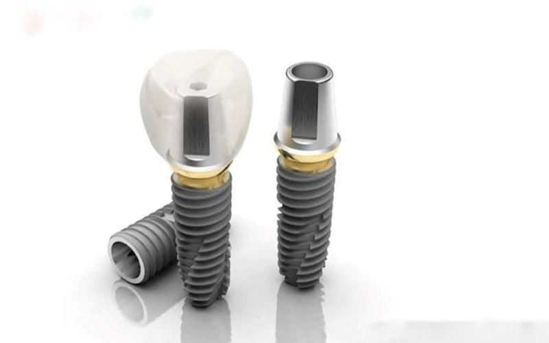 Trồng răng implant Hàn Quốc bằng trụ Dentium có ưu điểm