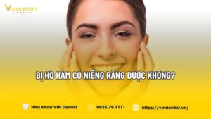 Bị Hô Hàm Có Niềng Răng Được Không?