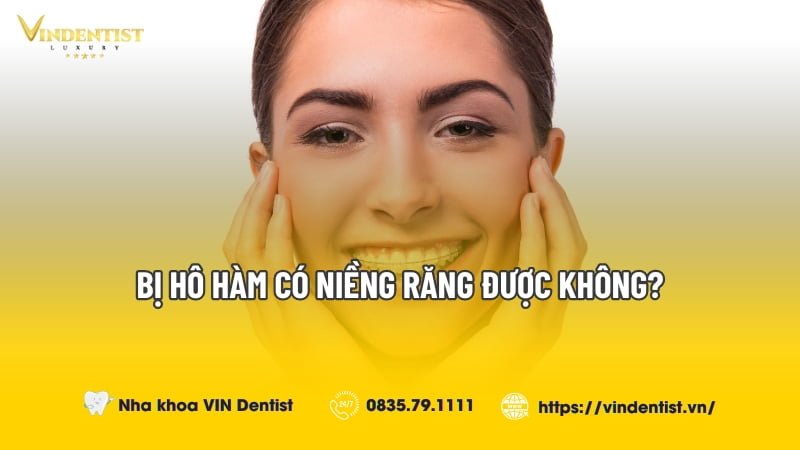 Bị Hô Hàm Có Niềng Răng Được Không?