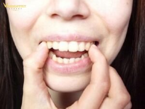 Dùng tay ấn lực vừa đủ vào răng