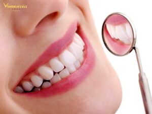 Bạn có thể bị hô hàm nếu có người thân gặp tình trạng này