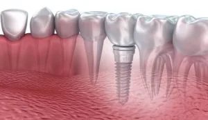 Nha Khoa VIN Dentist Đà Nẵng