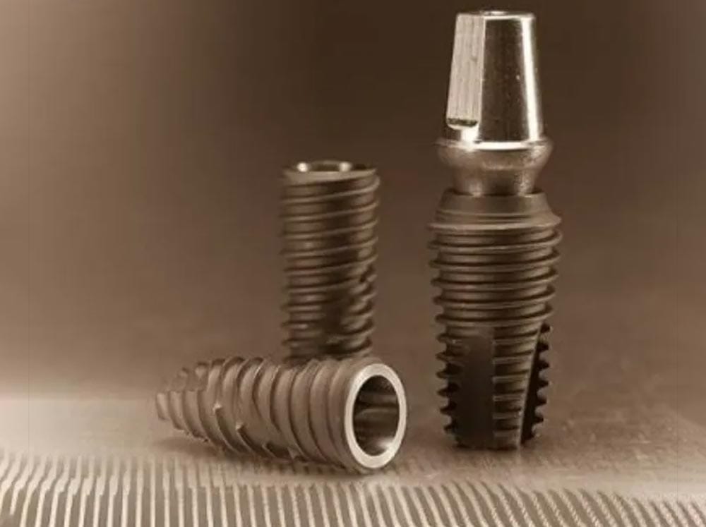 Implant Hiossen Mỹ - Khái niệm, lợi ích và chi phí 5 trụ implant Hiossen Mỹ