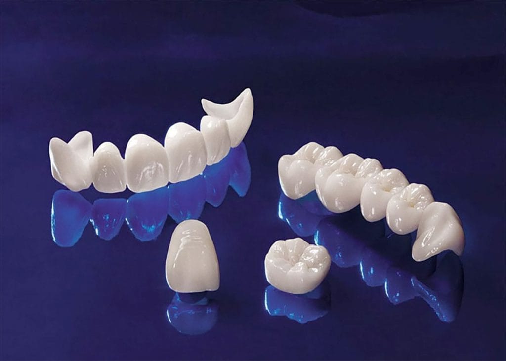 Răng sứ Zirconia là gì? Có bao nhiêu loại răng sứ Zirconia? 5 răng sứ Zirconia
