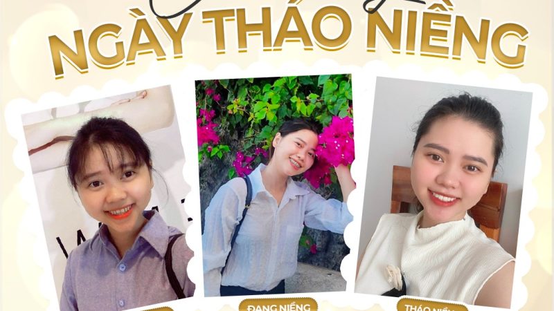 Khách hàng tháo niềng Thu Hà Khách hàng tháo niềng Thu Hà